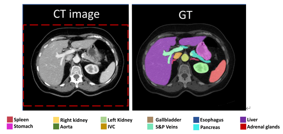 深度学习算法的5种标志性用途 _ 图像识别技术前瞻