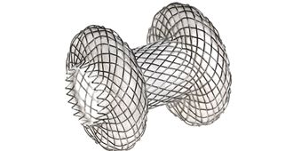 波科支架怎么样五分钟解决胰腺假性囊肿，波科AXIOS支架和电灼增强输送系统 ｜ 盖伦奖提名医械详解Ⅹ_https://www.jmylbn.com_新闻资讯_第8张