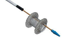 波科支架怎么样五分钟解决胰腺假性囊肿，波科AXIOS支架和电灼增强输送系统 ｜ 盖伦奖提名医械详解Ⅹ_https://www.jmylbn.com_新闻资讯_第9张