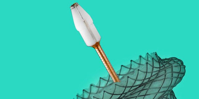 波科支架怎么样五分钟解决胰腺假性囊肿，波科AXIOS支架和电灼增强输送系统 ｜ 盖伦奖提名医械详解Ⅹ_https://www.jmylbn.com_新闻资讯_第12张