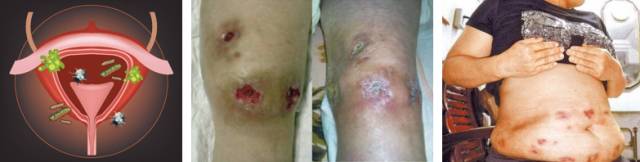 合理使用抗菌材料,医疗抗菌大有作为? 图片