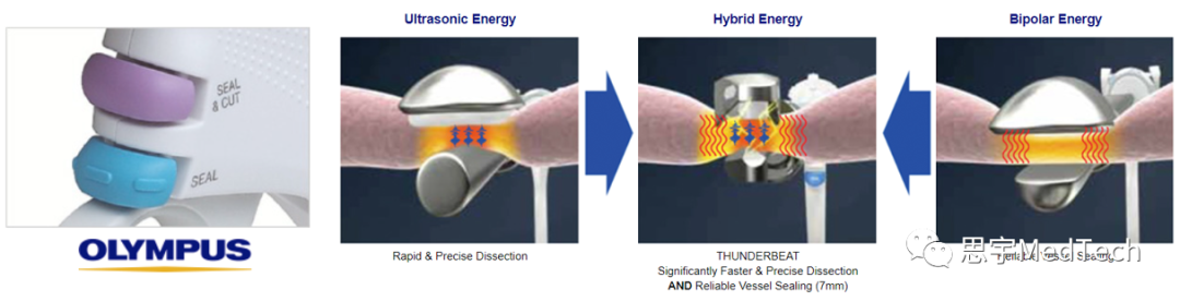 美国超声刀有哪些品牌数据 ｜ 盘点12家超声刀企业_https://www.jmylbn.com_新闻资讯_第5张