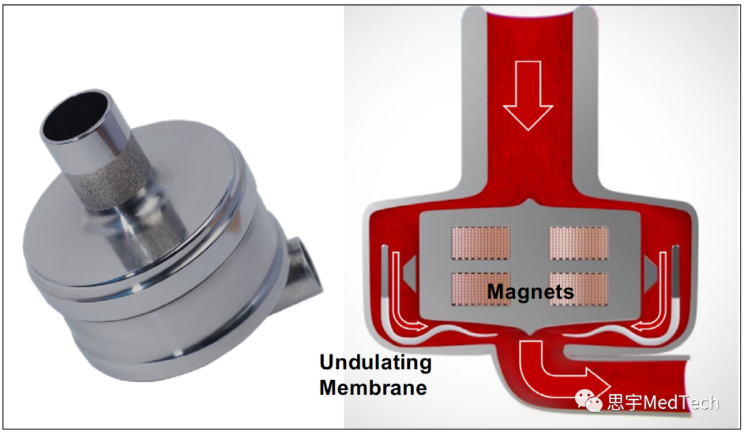 医生专栏 | 下一代人工心脏(图7)