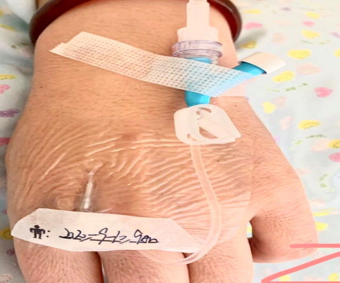 为什么输血不能用小针“静”系生命   “针”心呵护_https://www.jmylbn.com_新闻资讯_第5张