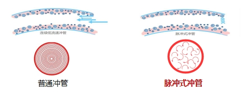 为什么输血不能用小针“静”系生命   “针”心呵护_https://www.jmylbn.com_新闻资讯_第6张