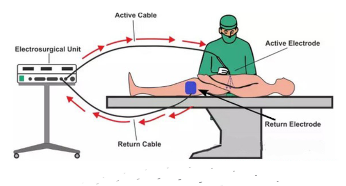 为什么电极能止血医加百科 ｜ 消融电极，看这篇就够了！_https://www.jmylbn.com_新闻资讯_第3张