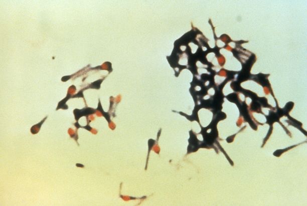 破伤风梭状芽胞杆菌(clostridium tetani)是一种细菌病原体,是一种