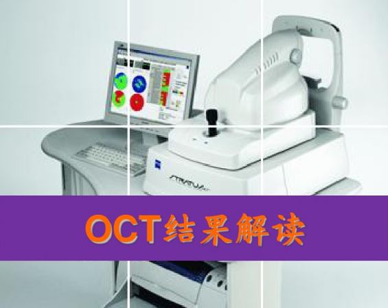 眼科新手必读 Oct结果解读