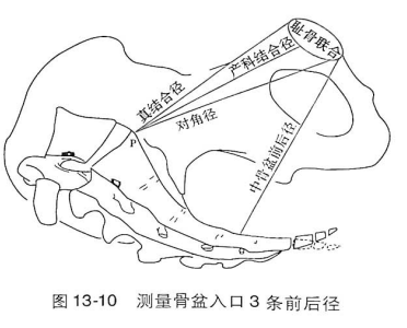 产前检查 房产新闻