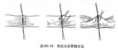 怎么区分显微剪刀医学科普：显微外科技术_https://www.jmylbn.com_新闻资讯_第5张