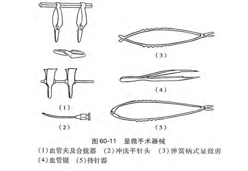 怎么区分显微剪刀医学科普：显微外科技术_https://www.jmylbn.com_新闻资讯_第3张