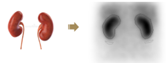 d-spect怎么检查为“肾”发声 SPECT-CT动态显像展神威 德州市第二人民医院SPECT-CT助力精准诊疗_https://www.jmylbn.com_新闻资讯_第4张