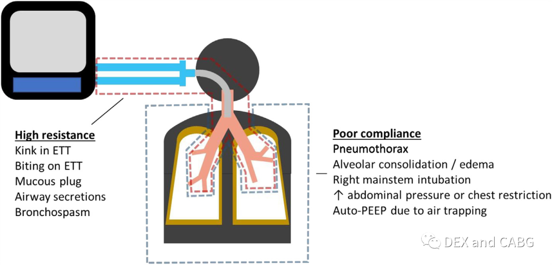 呼吸机是怎么给压力的机械通气的基本方式_https://www.jmylbn.com_新闻资讯_第7张