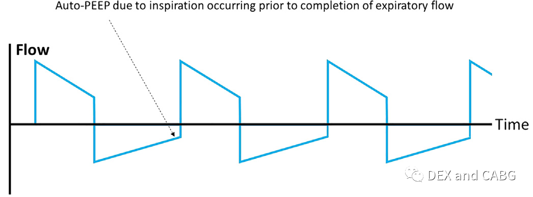 呼吸机是怎么给压力的机械通气的基本方式_https://www.jmylbn.com_新闻资讯_第17张