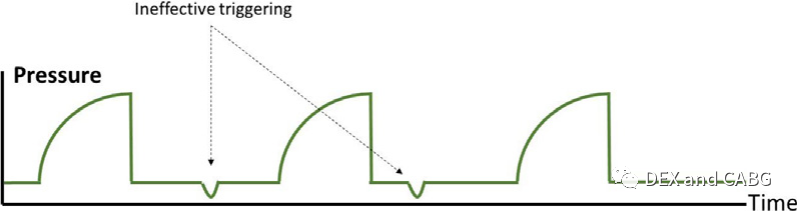 呼吸机是怎么给压力的机械通气的基本方式_https://www.jmylbn.com_新闻资讯_第22张