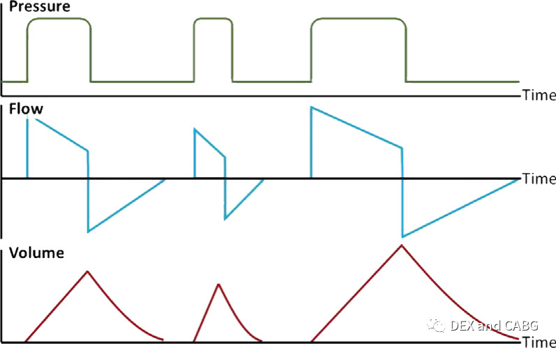 呼吸机是怎么给压力的机械通气的基本方式_https://www.jmylbn.com_新闻资讯_第15张