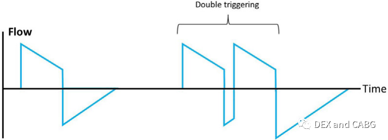 呼吸机是怎么给压力的机械通气的基本方式_https://www.jmylbn.com_新闻资讯_第23张