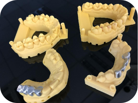 愛牙日 | 哎呀！以光固化3D打印之名解決你的牙齒問題的圖8