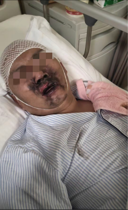 为什么吸氧管子是一边的关于吸氧的那些事儿_https://www.jmylbn.com_新闻资讯_第12张