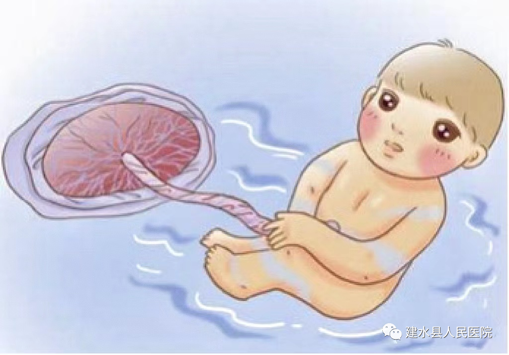 为什么新生儿抢救台【健康科普】早产儿生命的管道-脐静脉置管术_https://www.jmylbn.com_新闻资讯_第2张