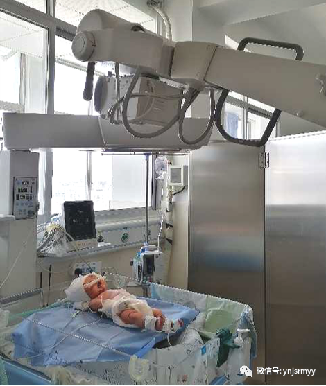 为什么新生儿抢救台【健康科普】早产儿生命的管道-脐静脉置管术_https://www.jmylbn.com_新闻资讯_第20张