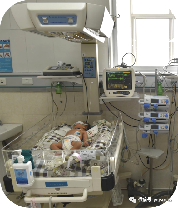为什么新生儿抢救台【健康科普】早产儿生命的管道-脐静脉置管术_https://www.jmylbn.com_新闻资讯_第16张
