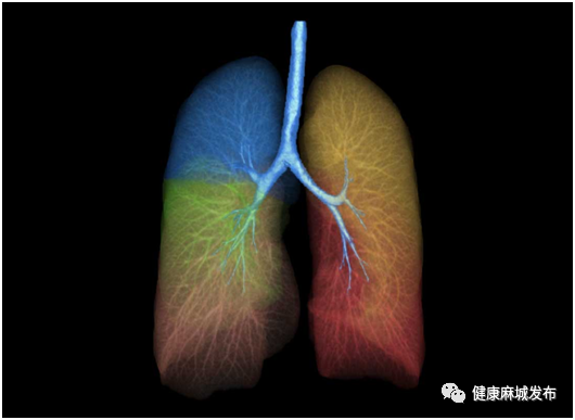 联影ct怎么样喜讯！麻城市四医院新添“大武器”——联影全智能天眼40排螺旋CT_https://www.jmylbn.com_新闻资讯_第5张