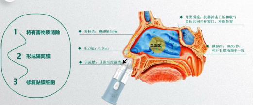 医用雾化机器怎么清洗浙江医院儿科雾化鼻腔冲洗上线！助力宝宝呼吸更通畅!_https://www.jmylbn.com_新闻资讯_第3张