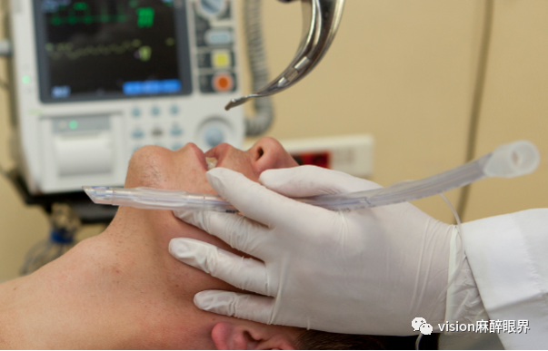 为什么要用喉罩热点回顾｜喉罩应用的五大误区_https://www.jmylbn.com_新闻资讯_第1张