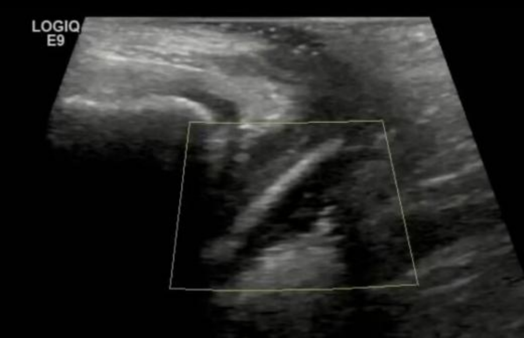 图源：科室供图