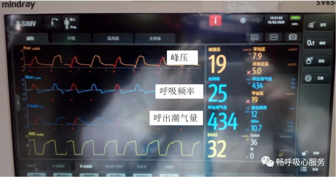 呼吸机是怎么给压力的呼吸机参数这么多，哪些需要掌握？_https://www.jmylbn.com_新闻资讯_第4张