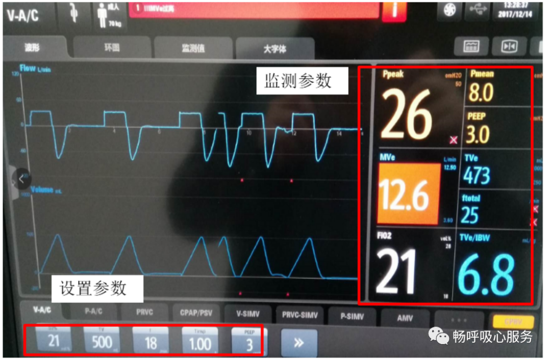 呼吸机是怎么给压力的呼吸机参数这么多，哪些需要掌握？_https://www.jmylbn.com_新闻资讯_第3张