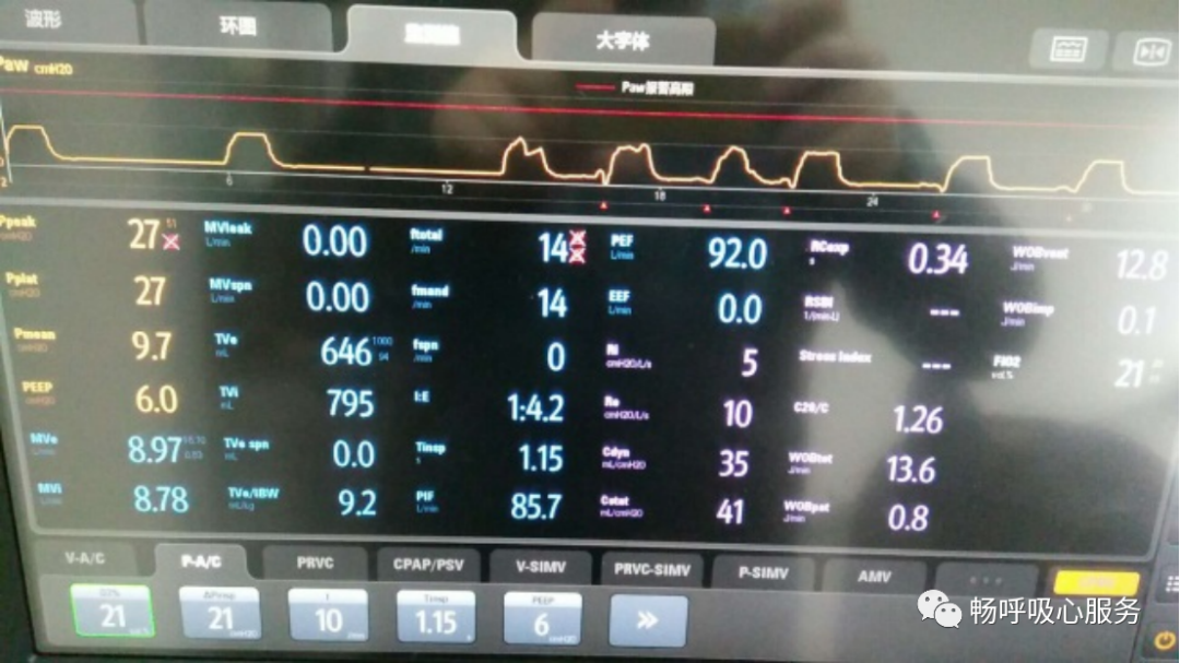 呼吸机是怎么给压力的呼吸机参数这么多，哪些需要掌握？_https://www.jmylbn.com_新闻资讯_第5张