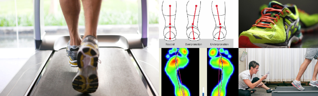 步态分析上曲线怎么解读超详细步态分析！一文读懂_https://www.jmylbn.com_新闻资讯_第16张