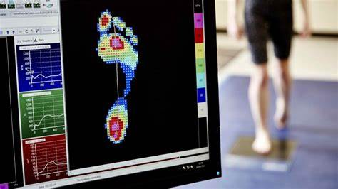 步态分析上曲线怎么解读超详细步态分析！一文读懂_https://www.jmylbn.com_新闻资讯_第13张