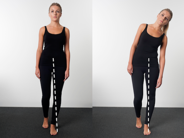 步态分析上曲线怎么解读步态分析，认识我们的步态和异常步态_https://www.jmylbn.com_新闻资讯_第13张