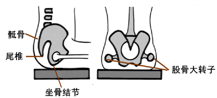 防压疮垫叫什么【辅具学堂】防压疮垫妙用知多少？_https://www.jmylbn.com_新闻资讯_第6张