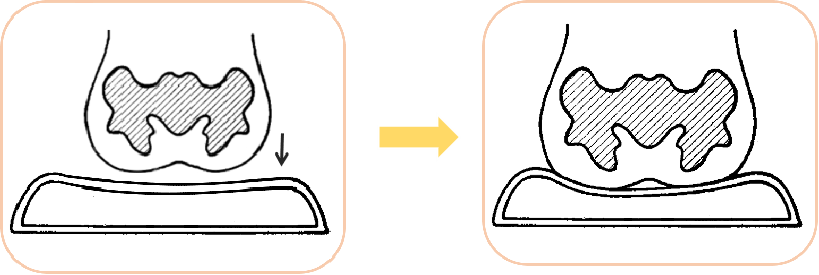 防压疮垫叫什么【辅具学堂】防压疮垫妙用知多少？_https://www.jmylbn.com_新闻资讯_第12张