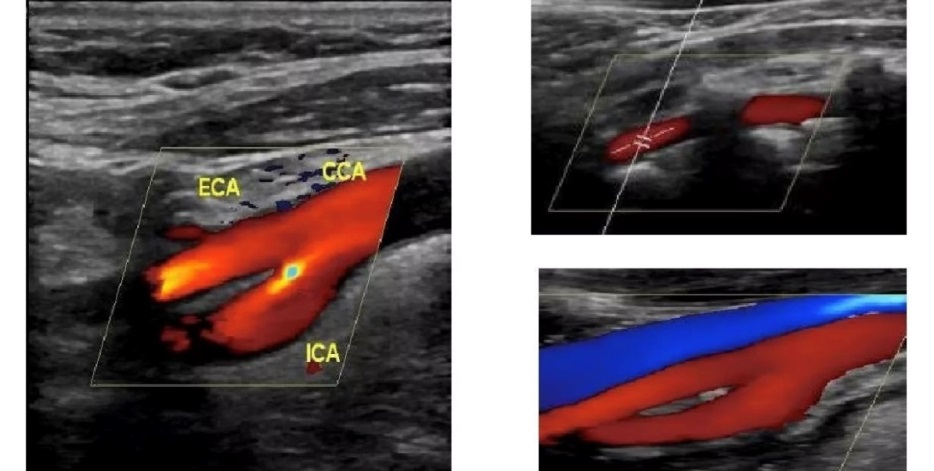 耦合剂怎么加热【儿医科普】做彩超对宝宝有伤害吗？关于彩超检查，你想知道的都在这里_https://www.jmylbn.com_新闻资讯_第3张