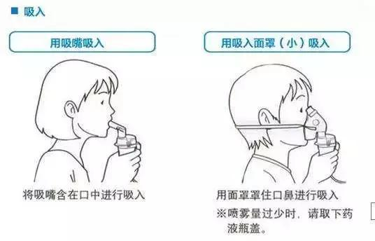 儿童雾化面罩怎么洗【儿医科普】咳！咳！咳！给孩子做雾化，这些知识您知道吗？_https://www.jmylbn.com_新闻资讯_第17张