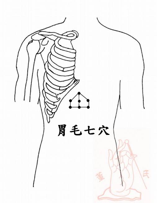 董氏土胃位置图片图片