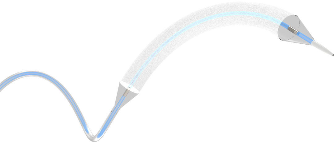 球囊是什么医疗器械业界快讯 ｜ 玮畅®“颅内动脉药物涂层球囊导管”进入创新医疗器械特别审查程序_https://www.jmylbn.com_新闻资讯_第2张