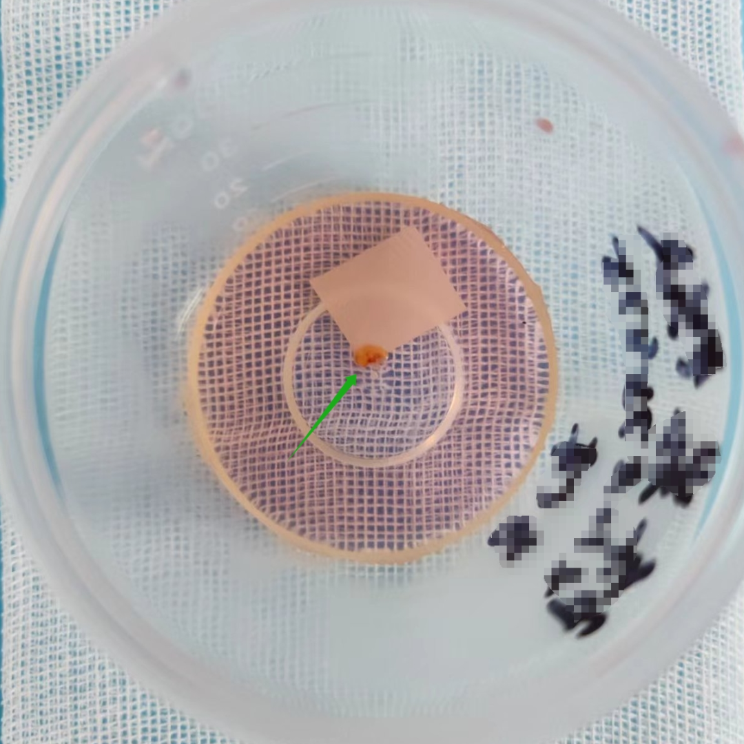 为什么说热活检钳做胃肠镜检查时，为什么要取活检？有必要吗？_https://www.jmylbn.com_新闻资讯_第3张