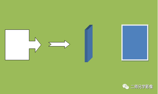 怎么取放射片放射拍片中的“几何学”，临床医生和技师都掌握了吗？_https://www.jmylbn.com_新闻资讯_第5张