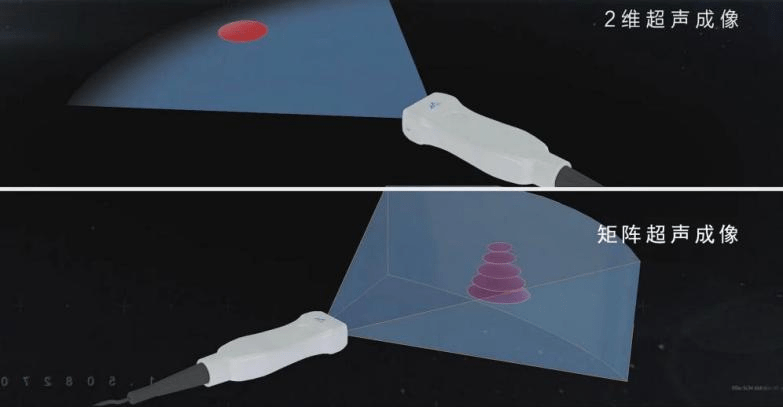 为什么要维修探头医疗科技创新新星——和声医疗高端超声探头_https://www.jmylbn.com_新闻资讯_第7张