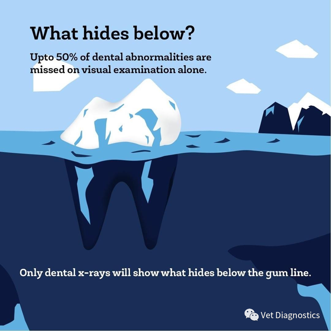 口腔 DR机器怎么用牙科X光（DR／CR）的重要性_https://www.jmylbn.com_新闻资讯_第2张