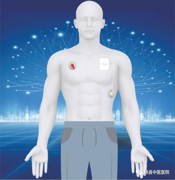 呼吸睡眠监测仪怎么用您睡觉的时候气还“顺”吗？“他”来告诉您——PSM100B便携式睡眠呼吸监测仪在我院健康管理中心正式投入使用_https://www.jmylbn.com_新闻资讯_第21张