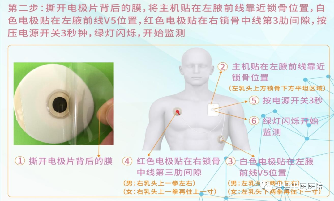 呼吸睡眠监测仪怎么用您睡觉的时候气还“顺”吗？“他”来告诉您——PSM100B便携式睡眠呼吸监测仪在我院健康管理中心正式投入使用_https://www.jmylbn.com_新闻资讯_第31张