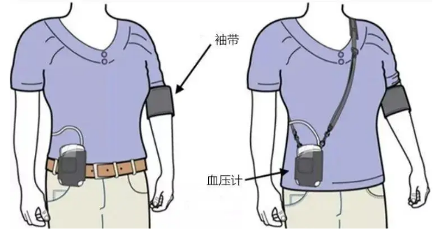 动态血压仪怎么安装24小时动态血压仪安装的注意事项_https://www.jmylbn.com_新闻资讯_第7张