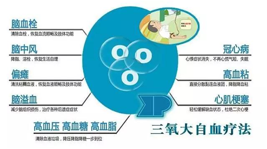 三氧治疗什么【科普】医用三氧自血疗法_https://www.jmylbn.com_新闻资讯_第5张